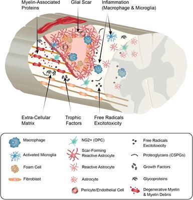 The Influence of Neuron-Extrinsic Factors and Aging on Injury Progression and Axonal Repair in the Central Nervous System